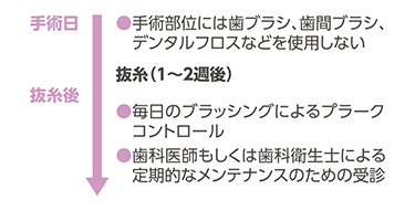 フラップ手術後のスケジュール（例）